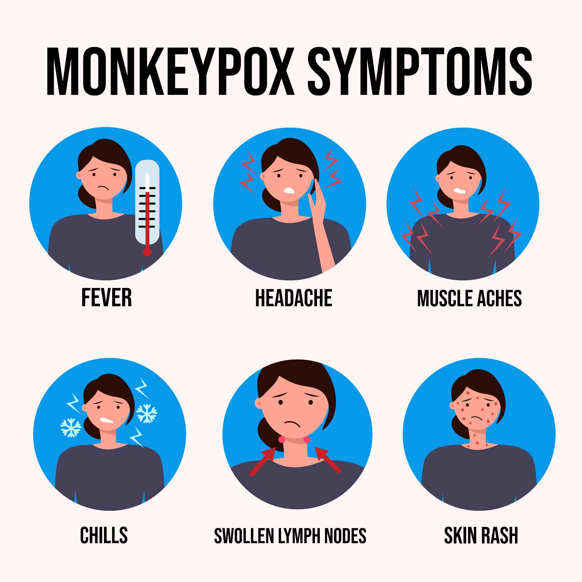 Monkeypox 2